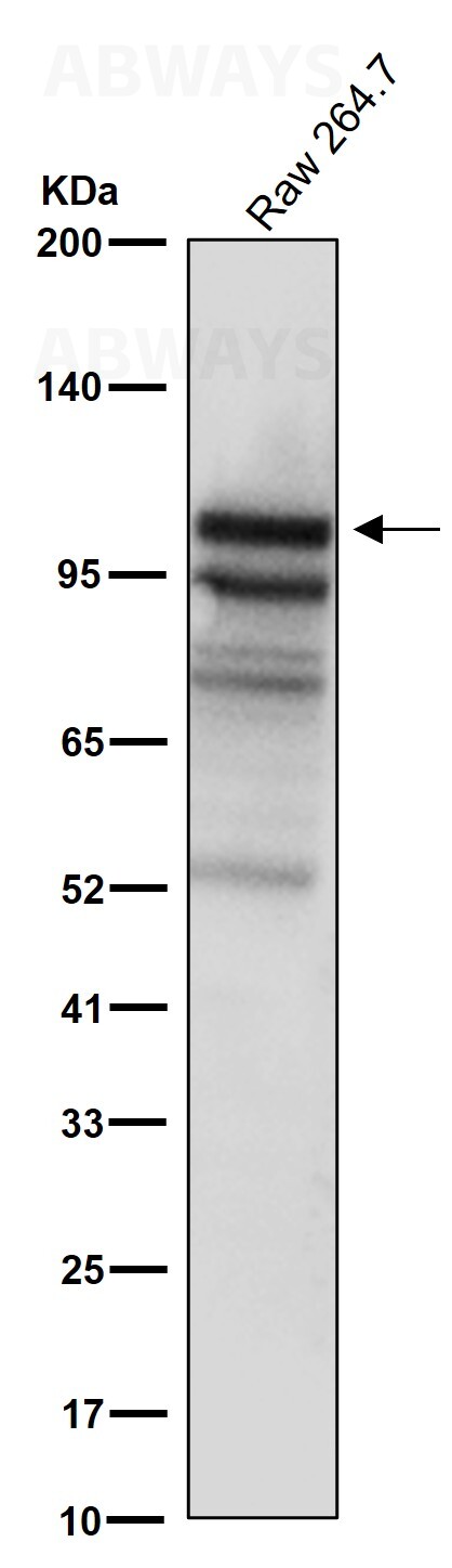 YTHDC1 Ab