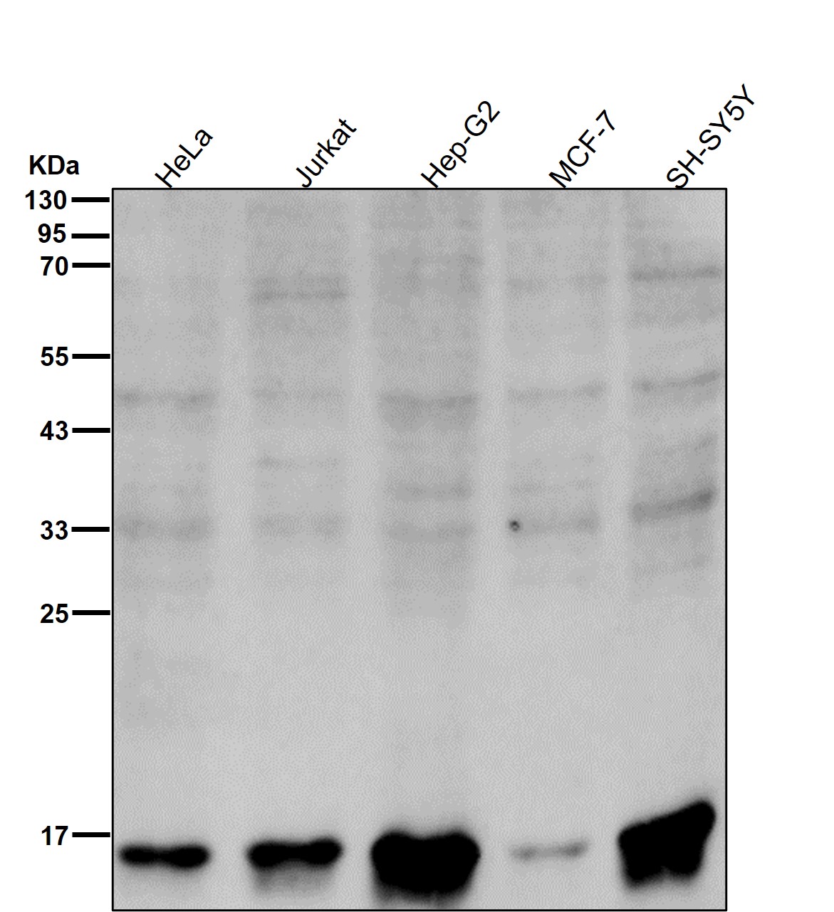 Acetyl-Histone H3 (K18) Ab