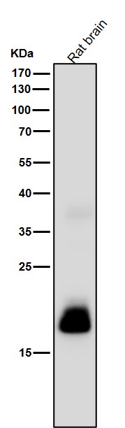 C reactive protein Ab