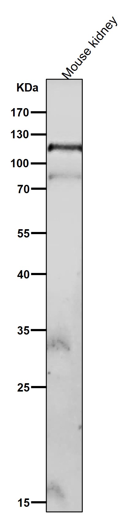 p-Focal adhesion kinase 1 (Y576/Y577) Ab