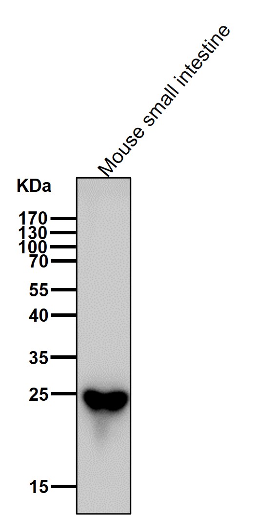 Lysophospholipase 1 Ab