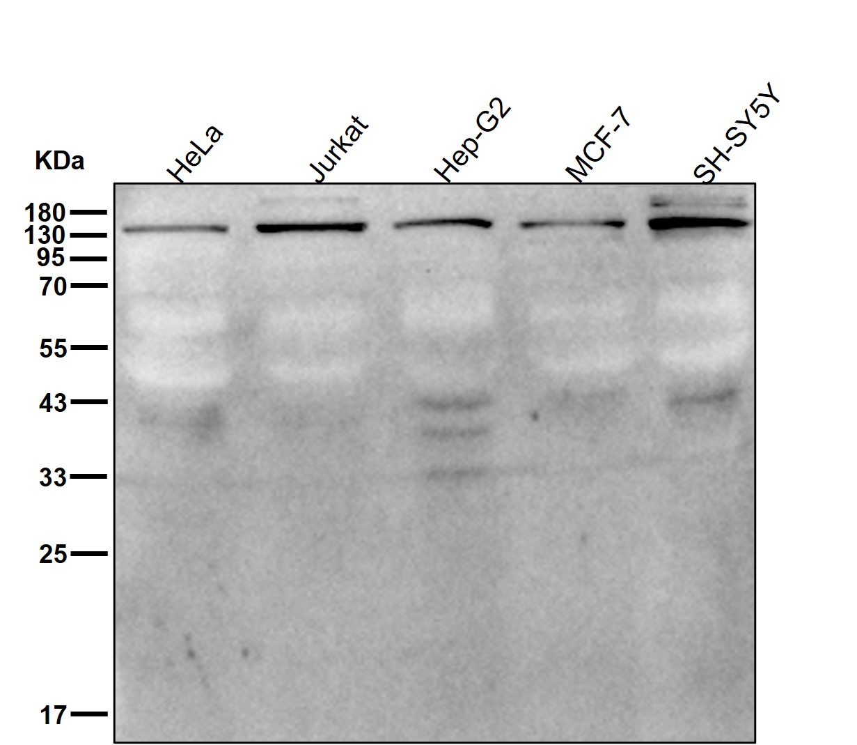 p-PLCB3 (S537) Ab