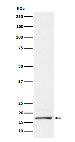 GCDFP 15 Ab