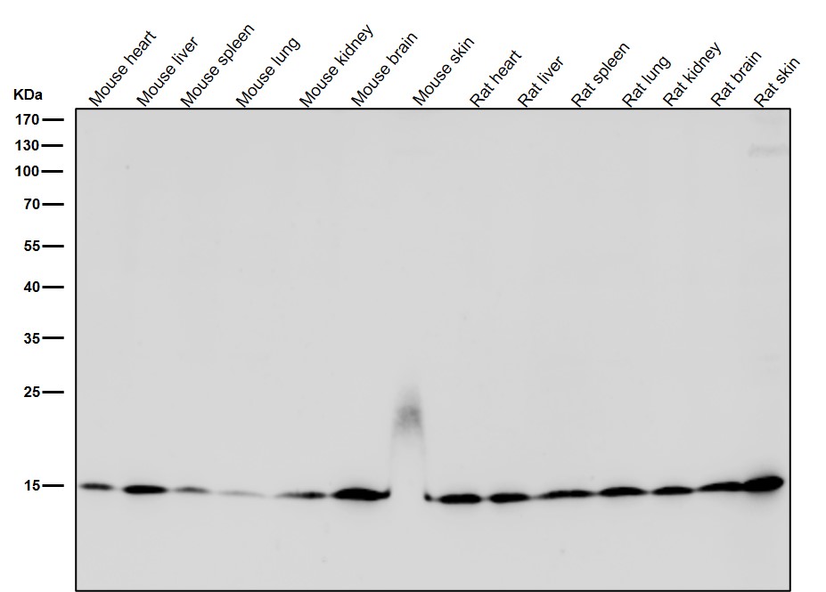 Acetyl-Histone H3 (K27) Ab