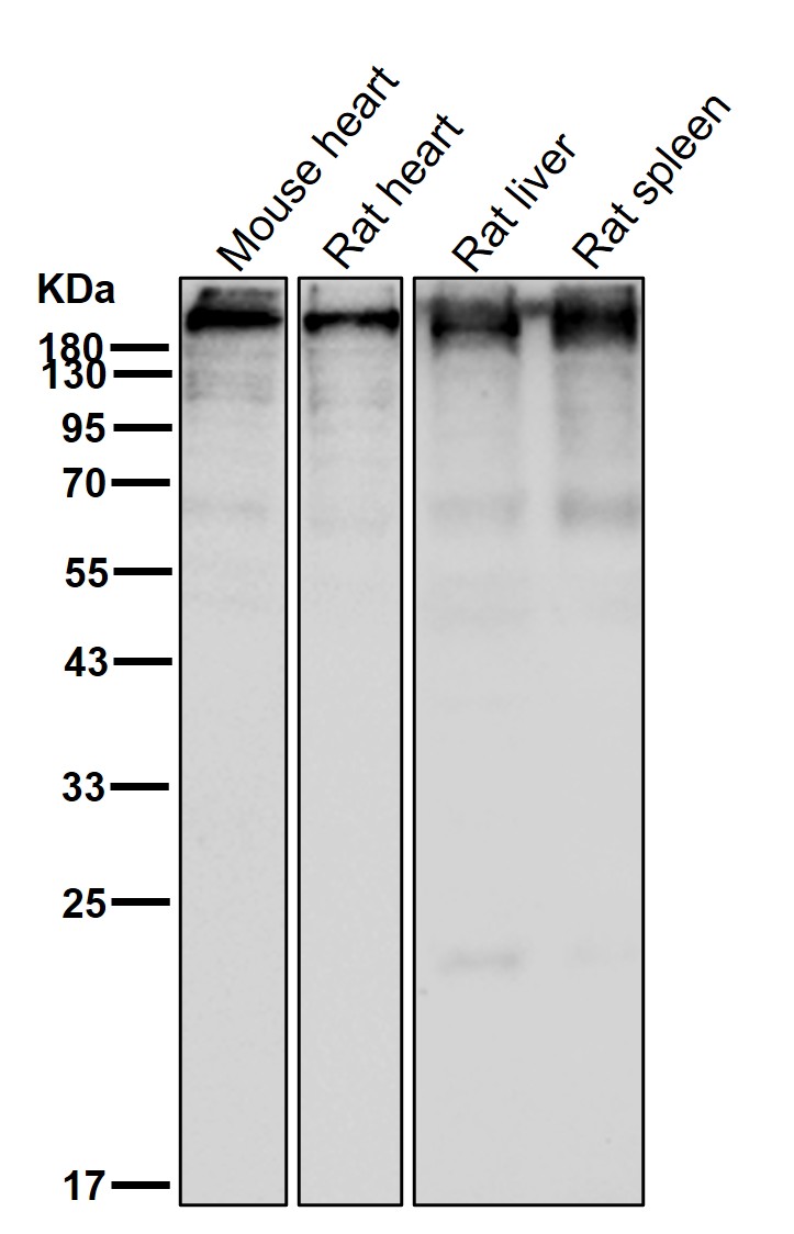 Desmoplakin Ab