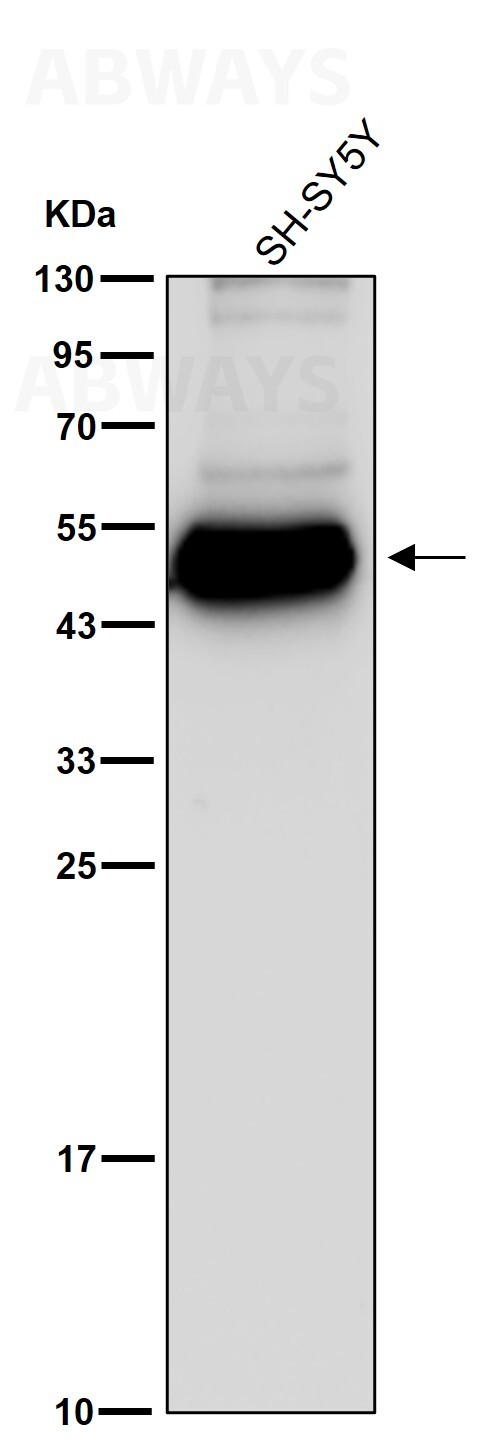 Human IgG1 Ab