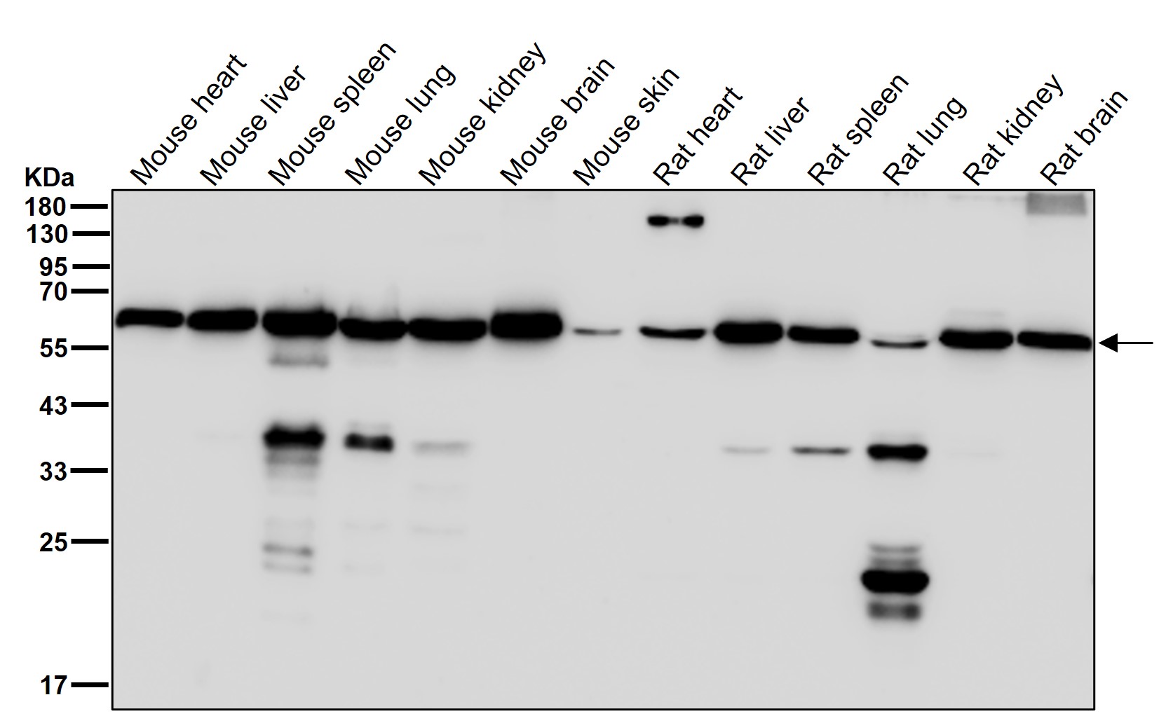 Leukotriene A 4 hydrolase Ab