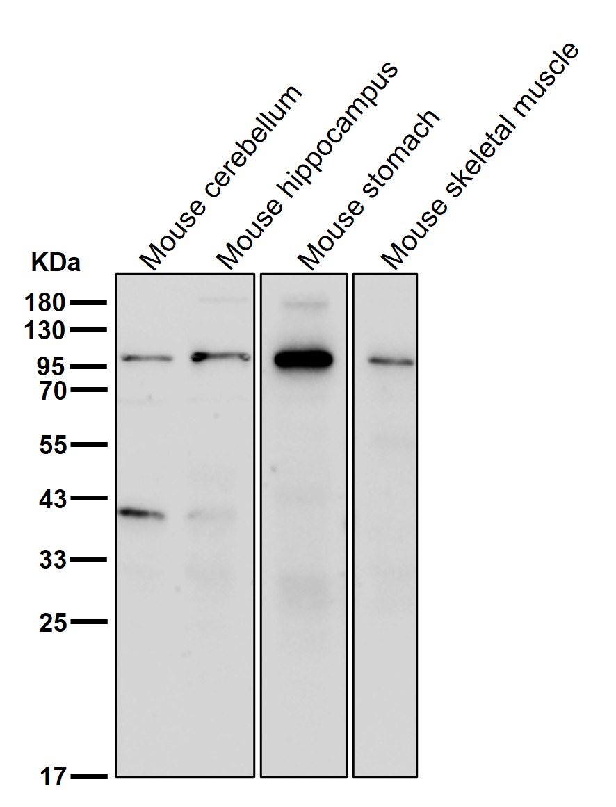 Lysosomal alpha glucosidase Ab