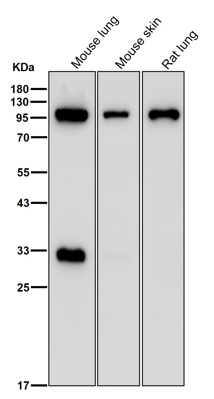 Lysosomal alpha glucosidase Ab