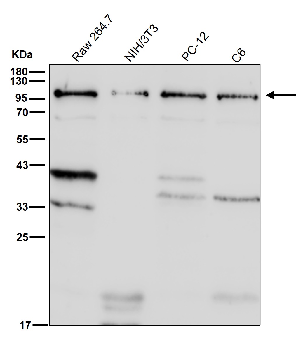Lysosomal alpha glucosidase Ab