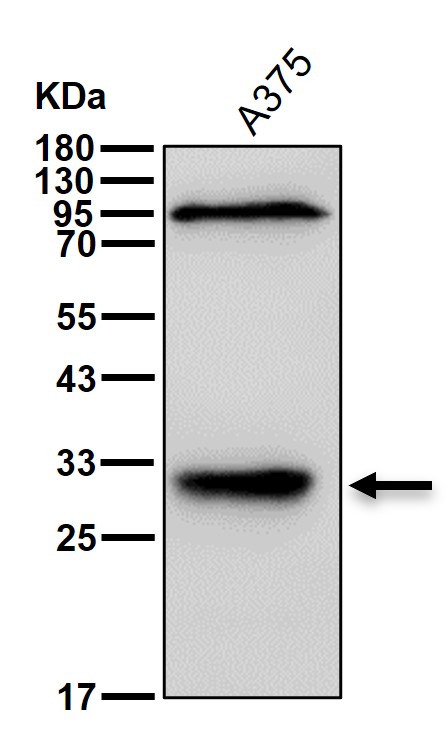 Kallikrein 5 Ab