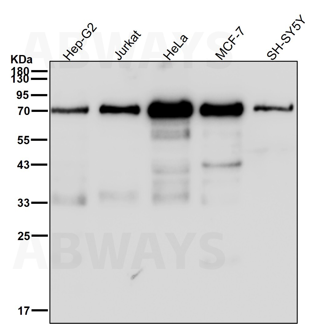 Lipoma preferred partner Ab