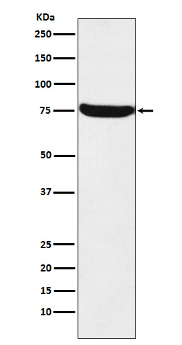 TRMT2A Ab