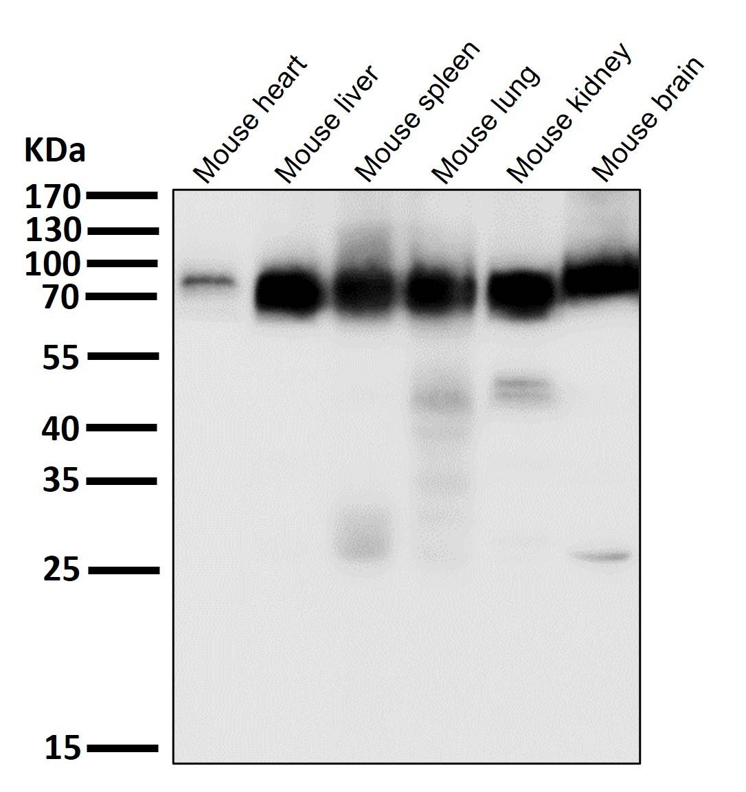 ACSL4 Ab