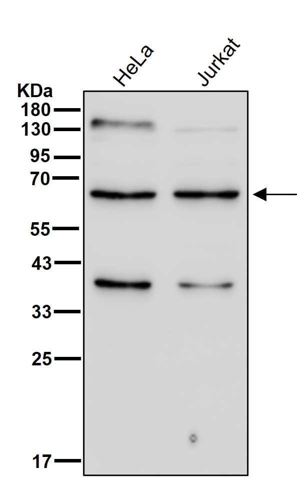 IGF2BP2 Ab