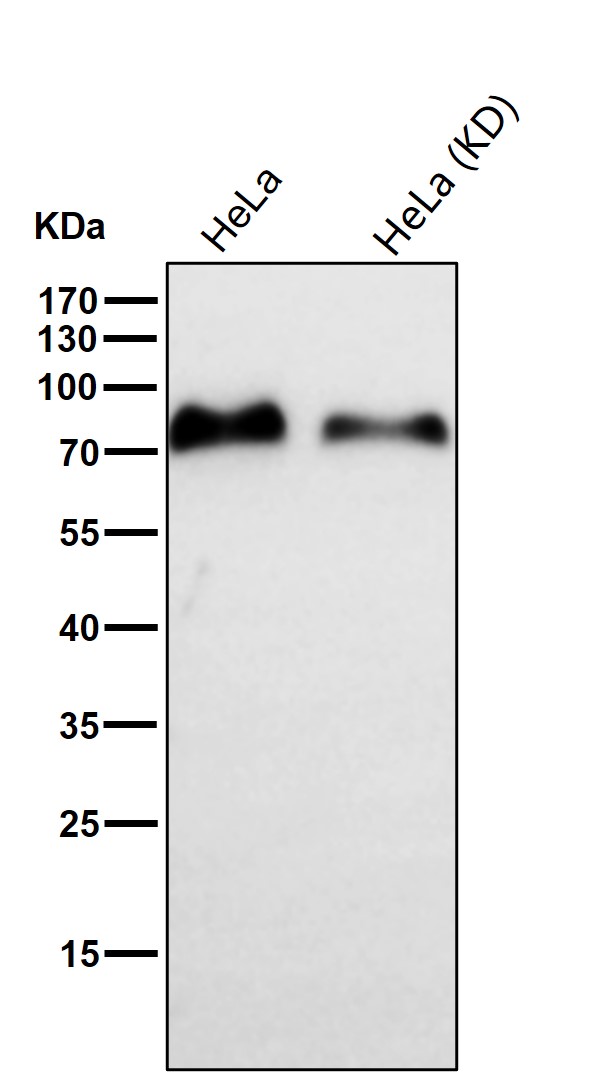 Glucosidase 2 beta Ab