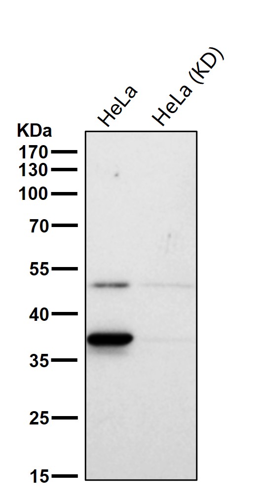 ACAT2 Ab