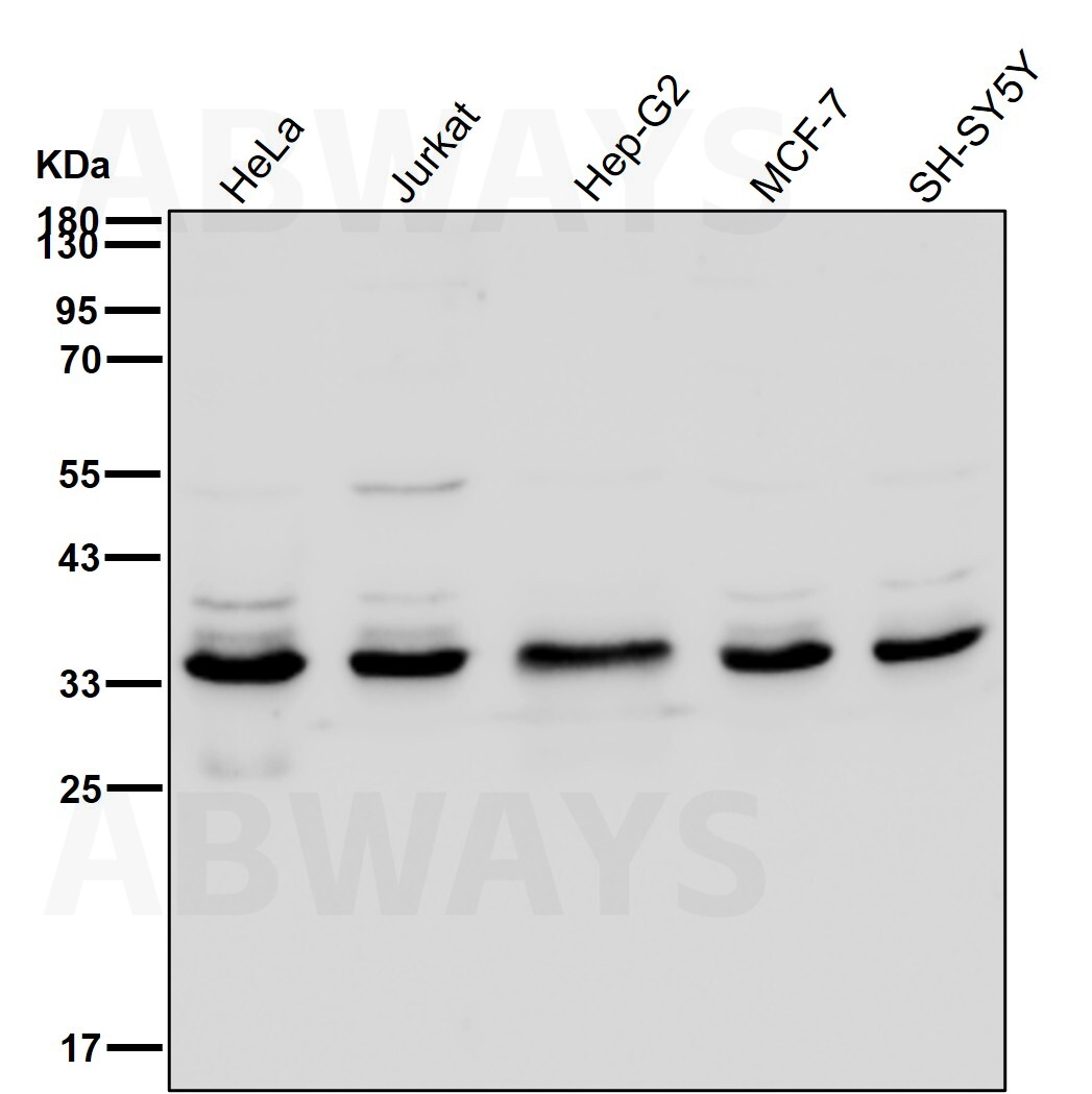 Complement C1q binding protein Ab