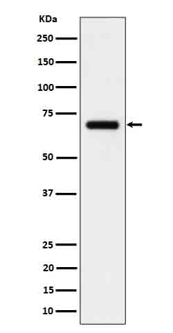 IL 5 receptor alpha Ab