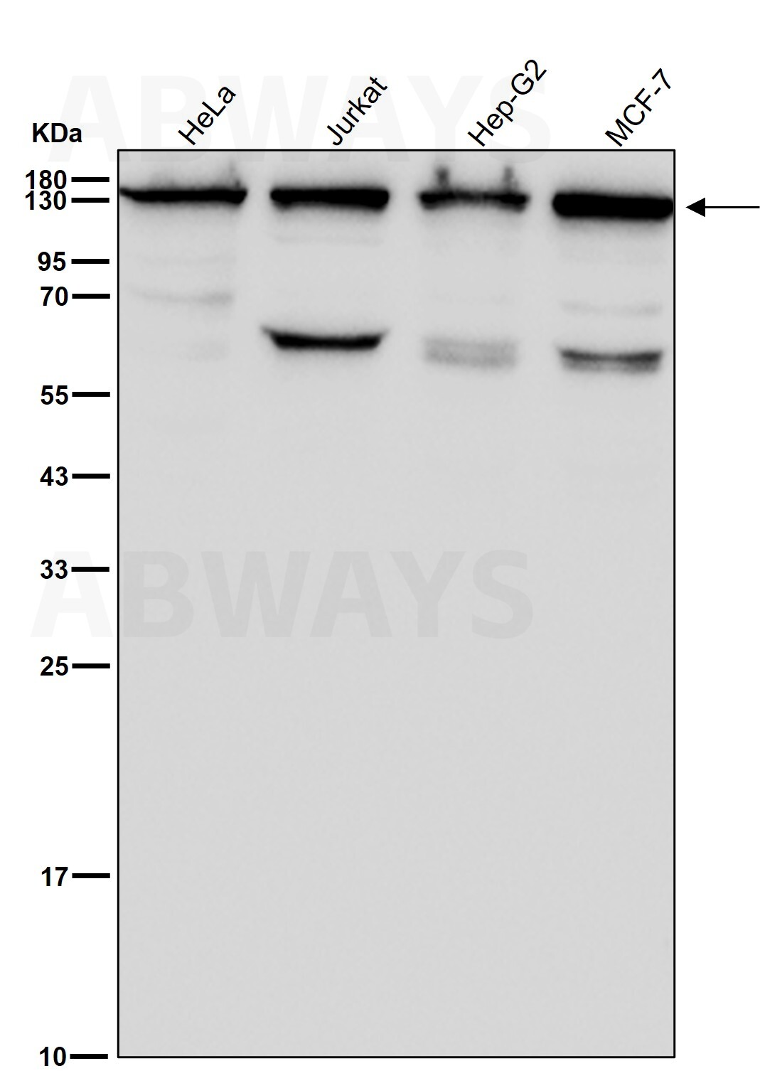 Condensin complex subunit 1 Ab