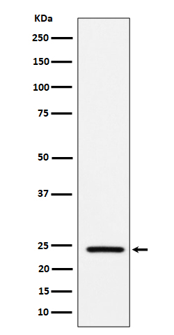 Acetyl-SOD2 (K68) Ab