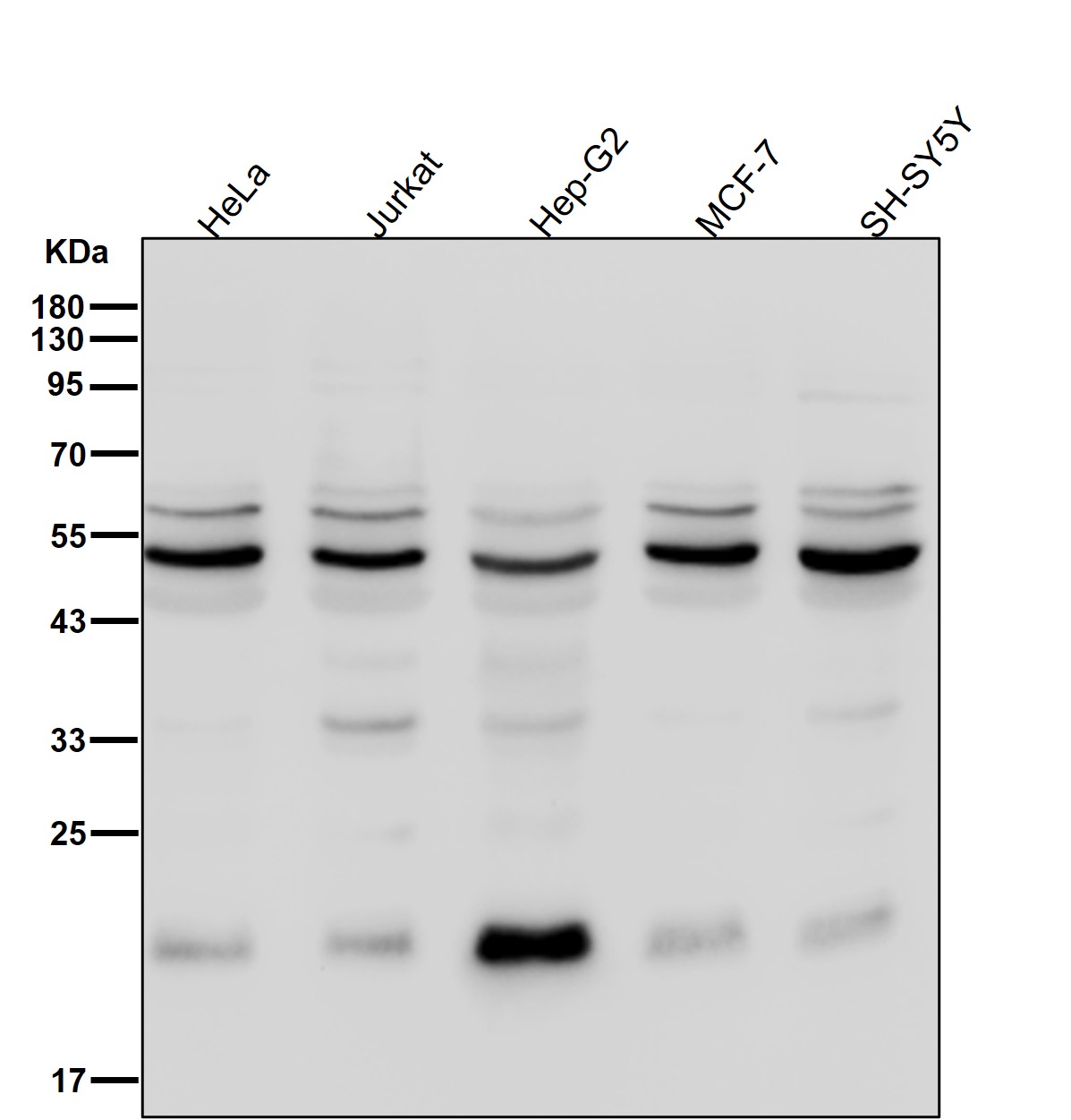 Histidine tRNA ligase Ab