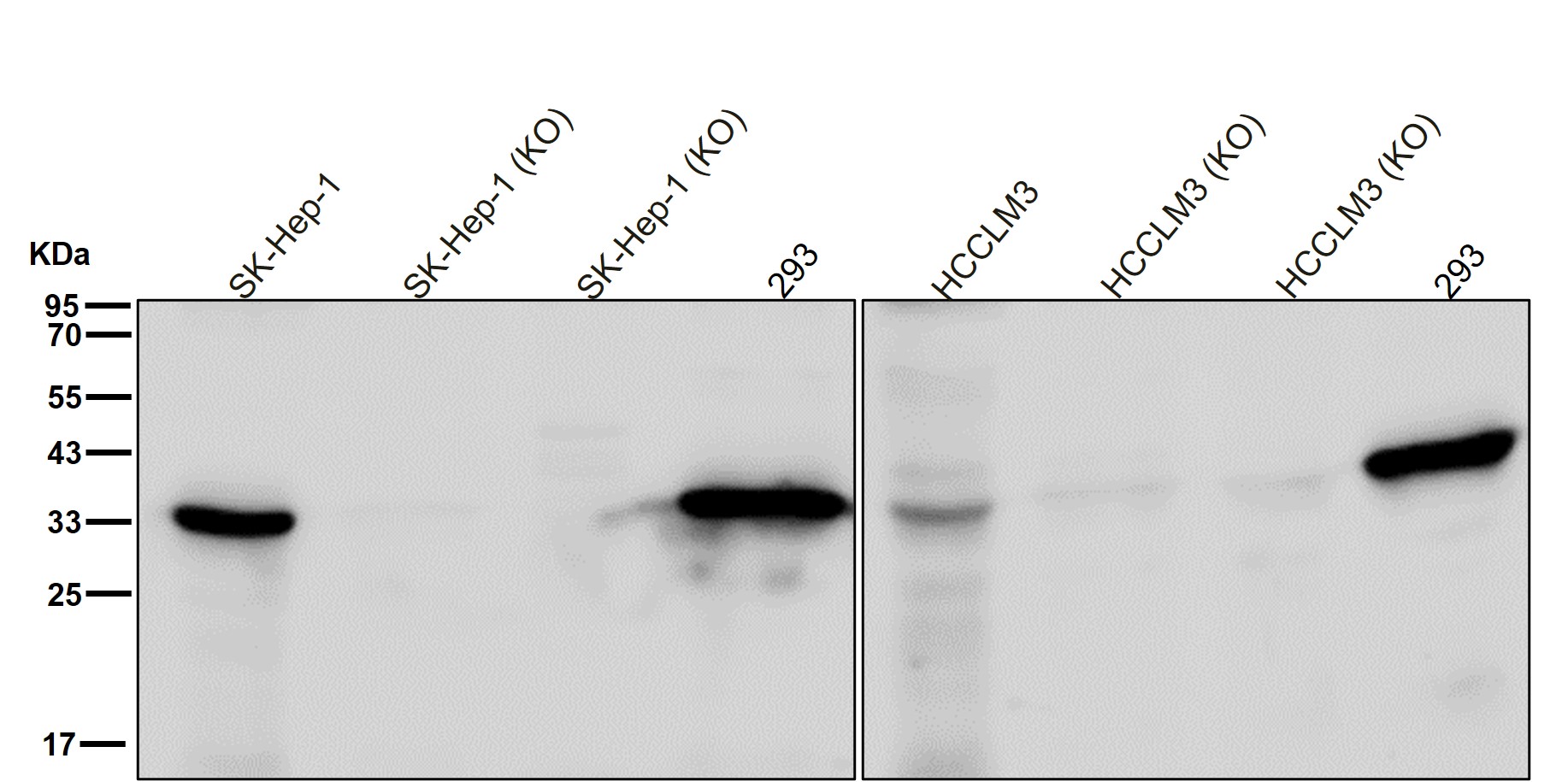 LDHC Ab
