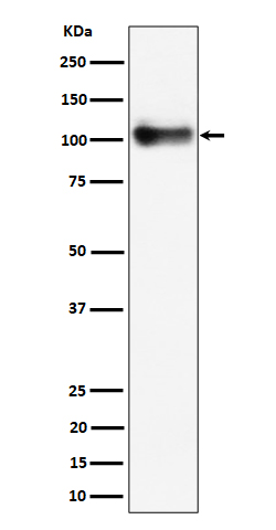 Thrombomodulin Ab