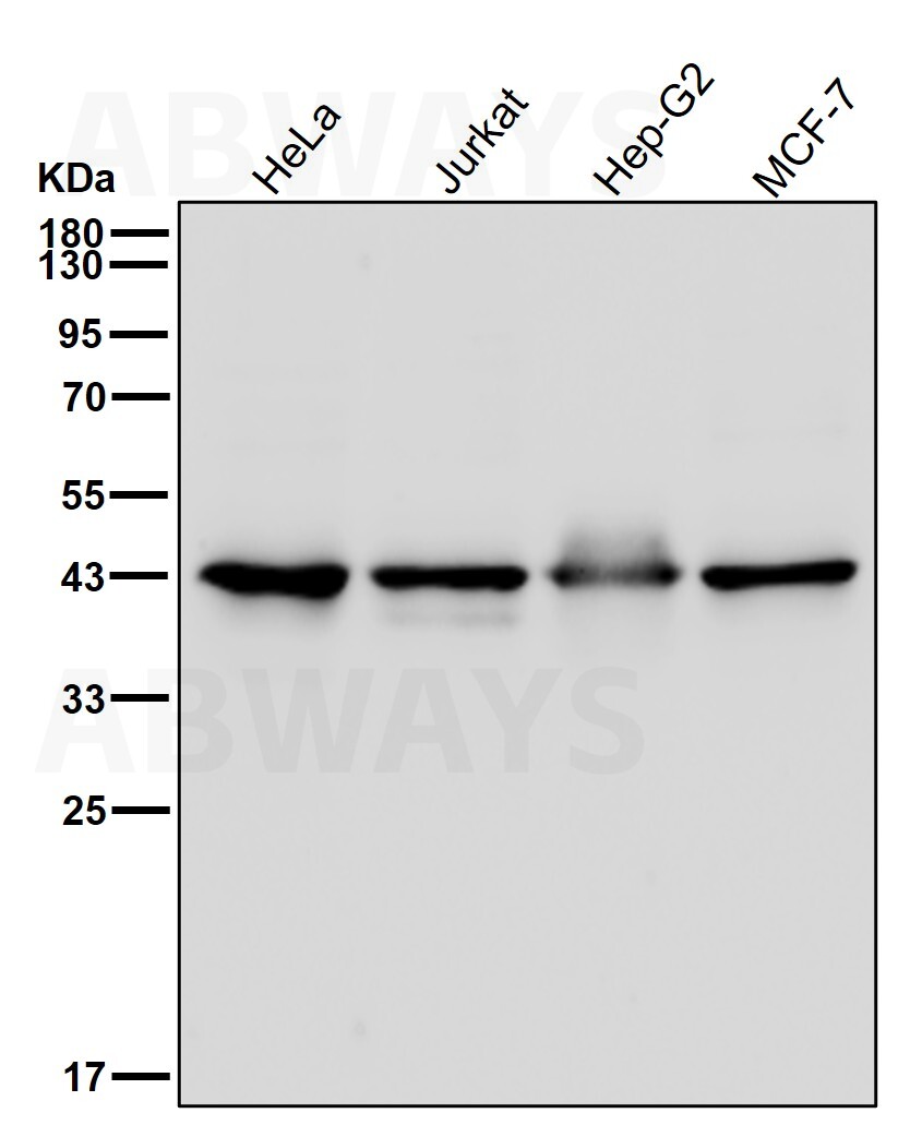Mevalonate kinase Ab
