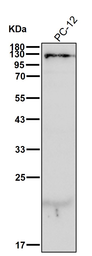 SPINK5 Ab