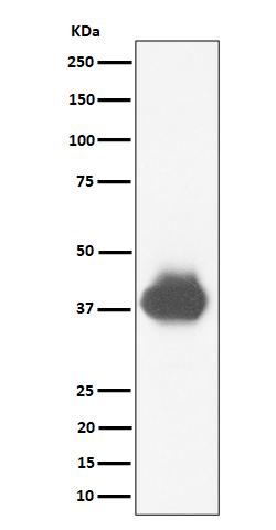CD32 Ab