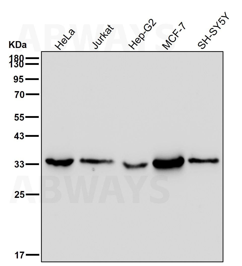 Inorganic pyrophosphatase Ab