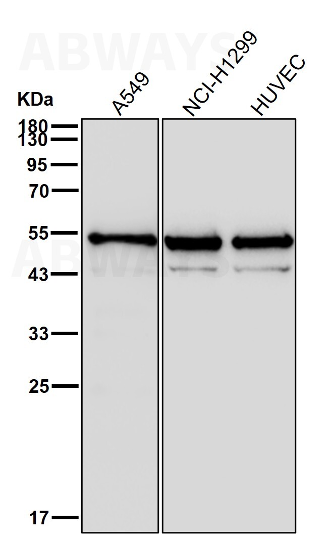 GPRC5B Ab