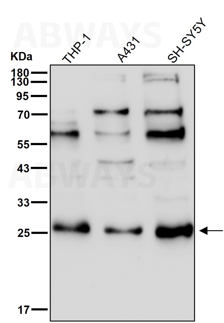 Peroxin 11B Ab