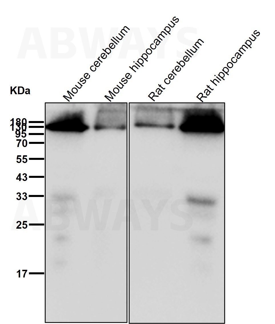 GluR1 (Y12) Rabbit mAb main image 1