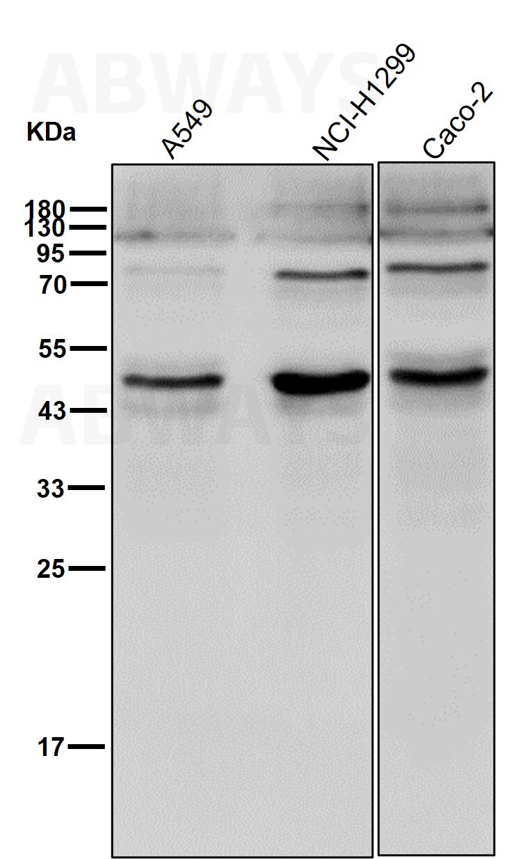 Protein Phosphatase 1 beta (P9) Rabbit mAb main image 1