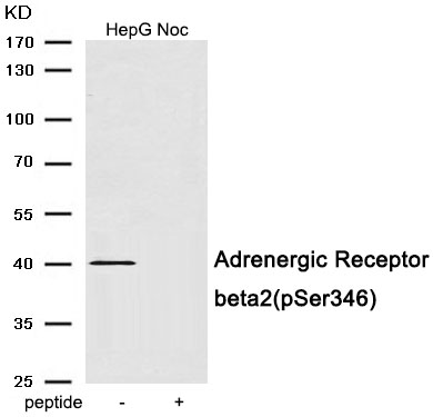 p-beta 2 Adrenergic receptor (S346) Ab