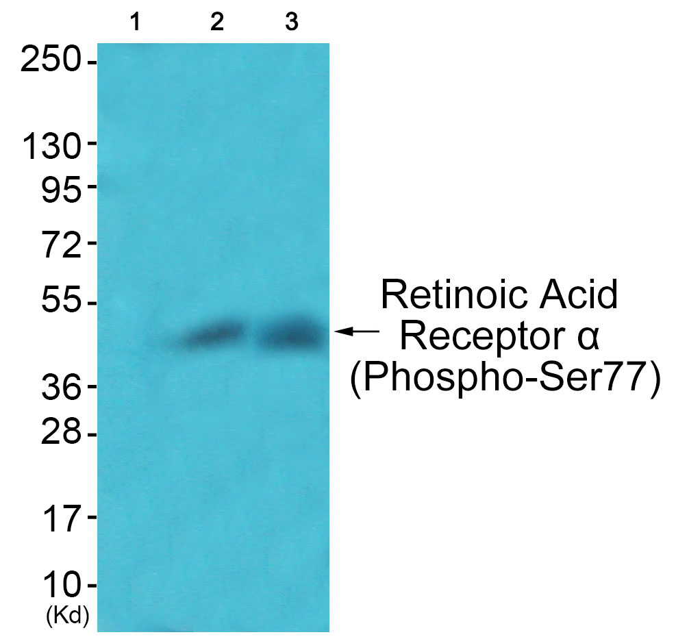 p-Retinoic acid receptor alpha (S77) Ab