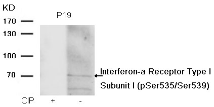 p-IFN alpha/beta receptor 1 (S535/S539) Ab