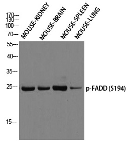 p-FADD (S194) Ab