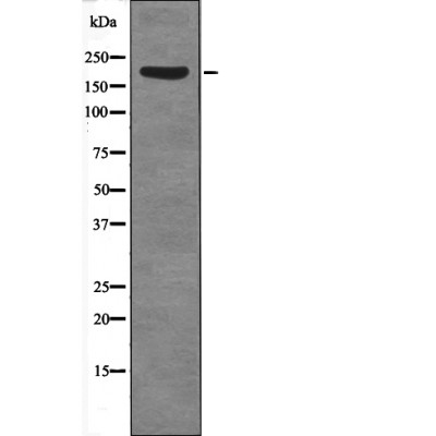 p-KAT13A (T1179) Ab