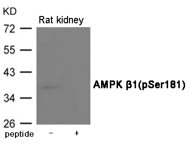 p-AMPK beta 1 (S181) Ab