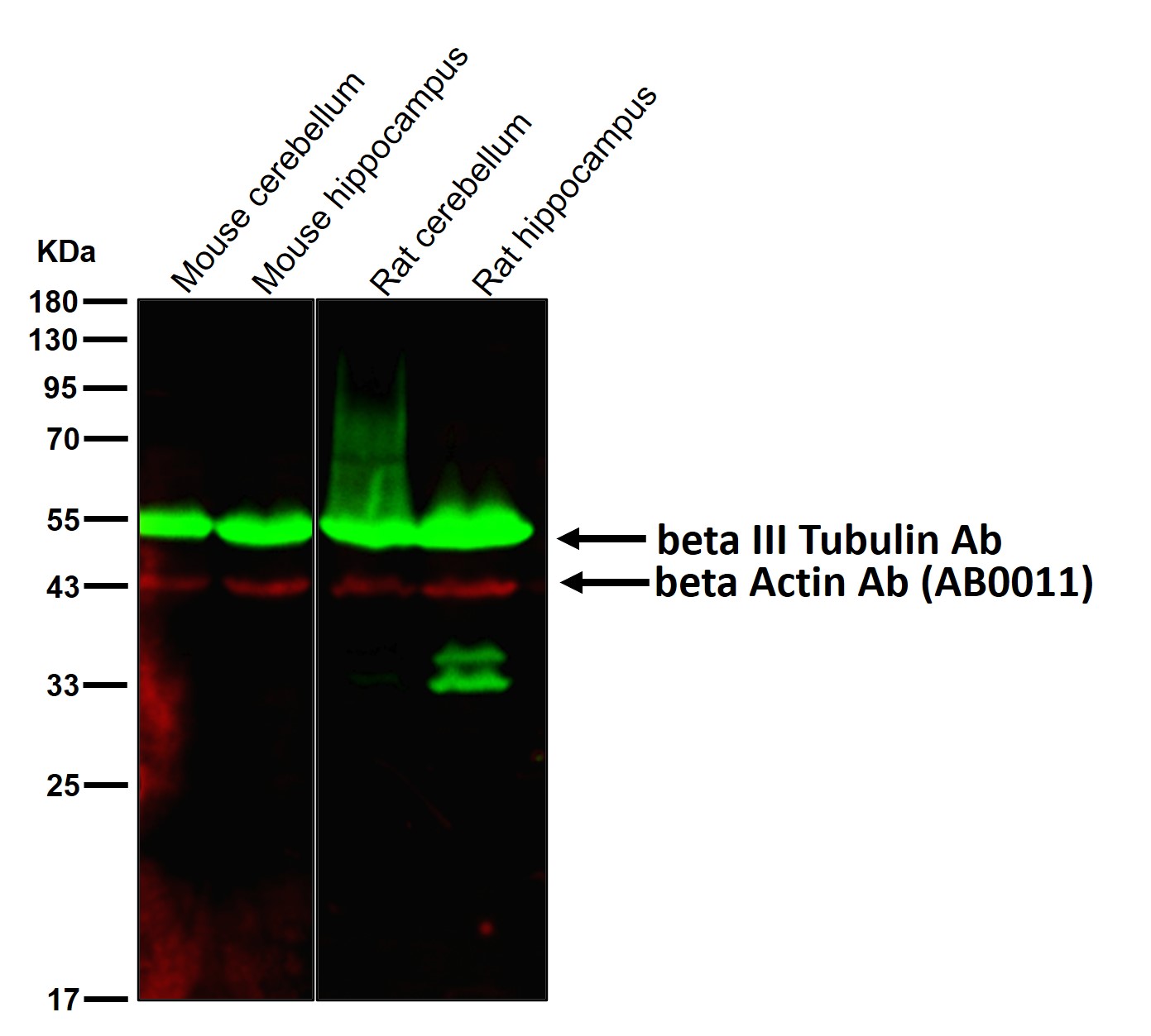 beta III Tubulin Ab
