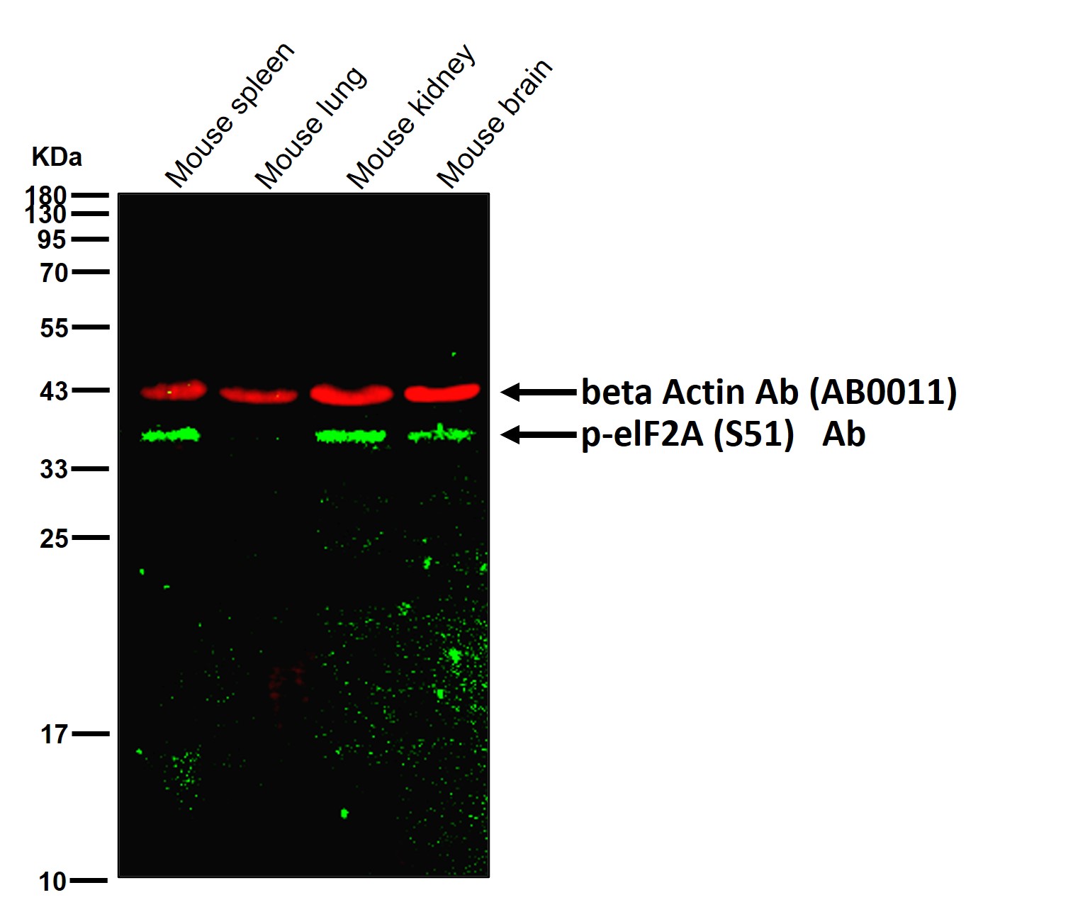 p-eIF2A (S51) Ab