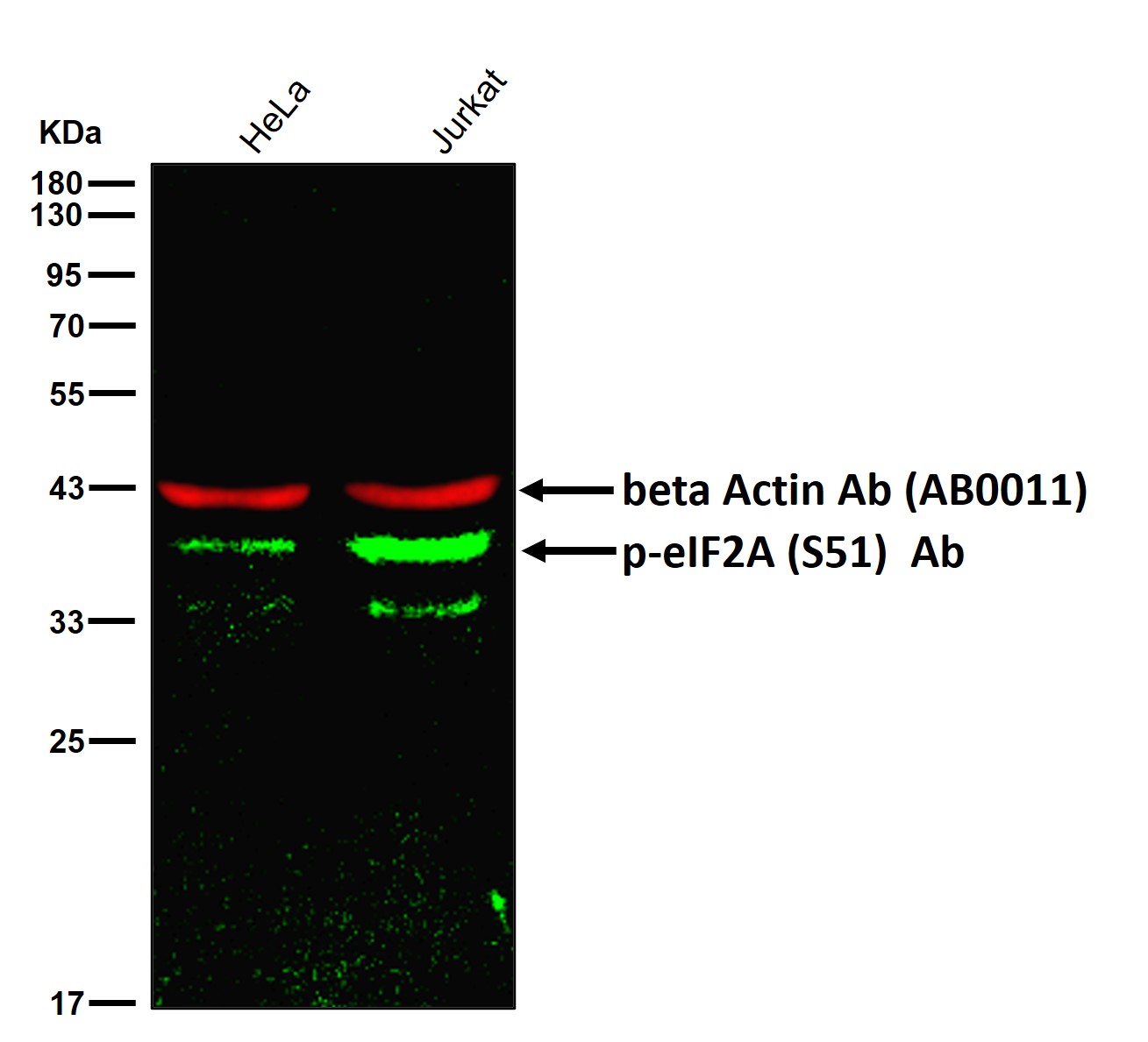 p-eIF2A (S51) Ab