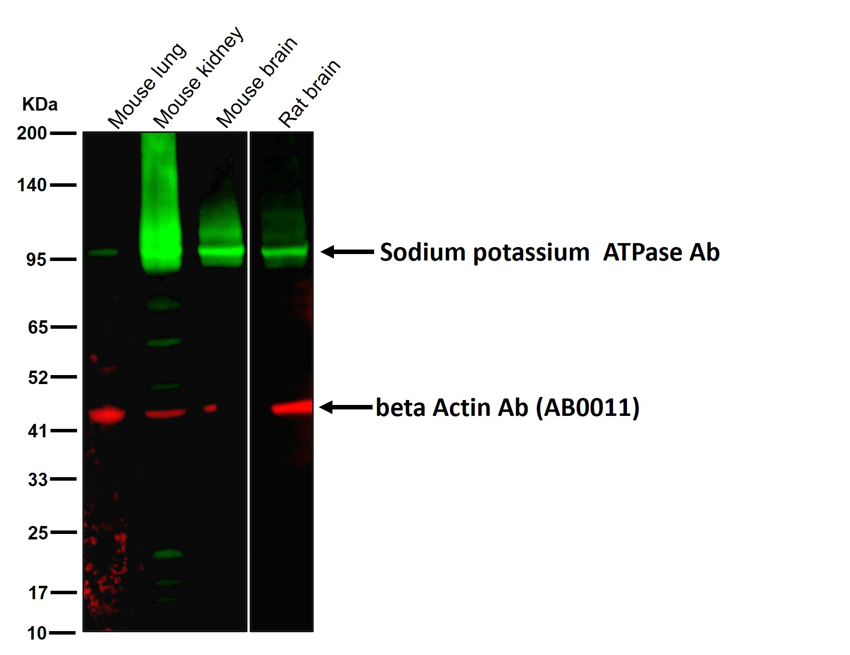 Sodium potassium ATPase Ab