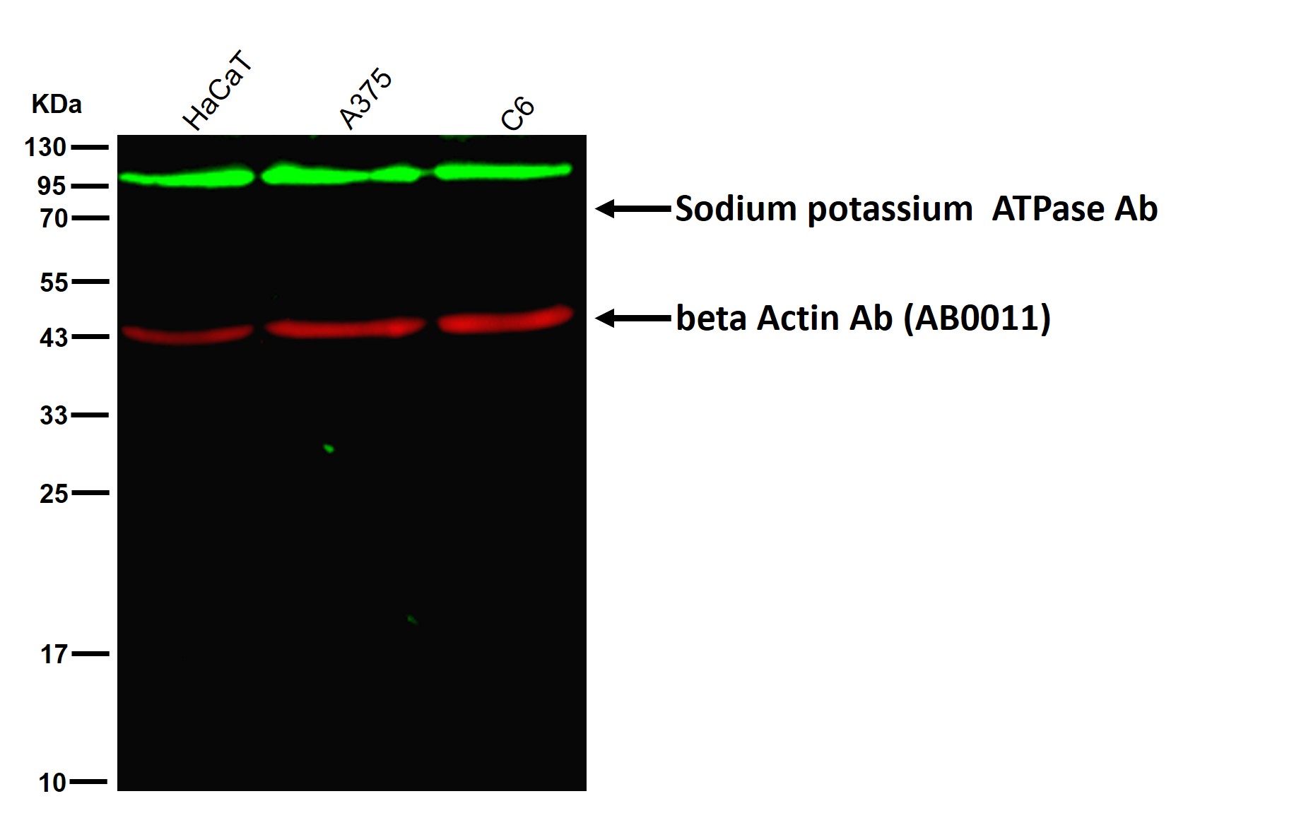 Sodium potassium ATPase Ab