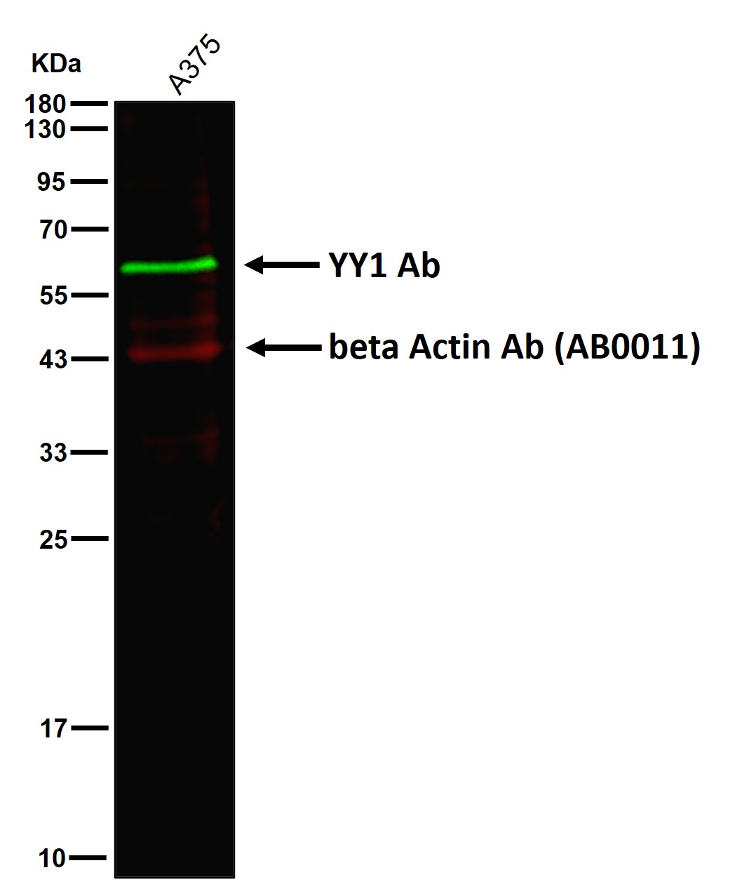 YY1 Ab