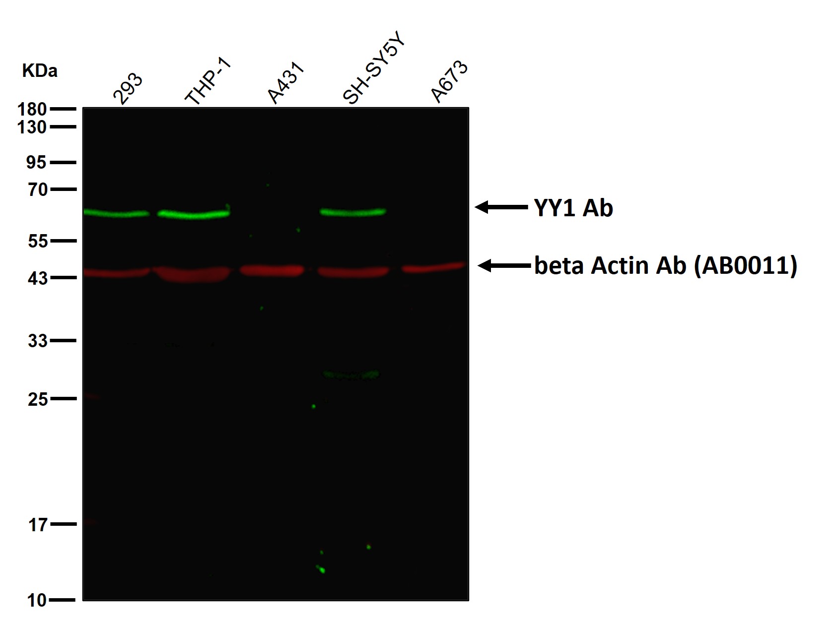 YY1 Ab