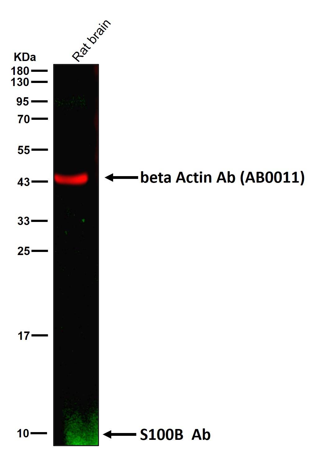 S100B Ab